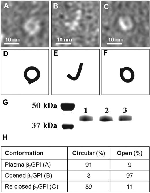 Figure 2. Conversion of different forms of β2GPI. Electron microscopy visualization of β2GPI treated at high and low pH. (A) Purified plasma β2GPI. (B) Plasma β2GPI after dialysis for 2 days at pH 11.5 with subsequent neutralization to pH 7.4. (C) Plasma β2GPI, first dialyzed against pH 11.5, then dialyzed for 2 days against pH 3.5 and subsequently neutralized to pH 7.4. (D-F) Representation of panels A through C, respectively. (G) SDS-PAA gel electrophoresis of purified plasma β2GPI (lane 1), β2GPI after dialysis against pH 11.5 (lane 2) and β2GPI first dialyzed against pH 11.5 followed by dialysis against pH 3.5 (lane 3). All 3 samples show a single band at approximately 43 kDa. (H) The percentages of circular and open conformation in purified plasma β2GPI (A), opened β2GPI (B), and reclosed β2GPI (C).