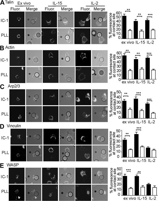 Figure 1. Binding of LFA-1 to ICAM-1 results in accumulation of talin, actin, Arp2/3, vinculin and WASP. Ex vivo, interleukin-15 (IL-15)–, or IL-2–activated splenic natural killer (NK) cells were incubated with intercellular adhesion molecule-1 (ICAM-1; IC-1)– or poly-L-lysine (PLL)–coated beads as indicated. Cells were fixed, permeabilized, and stained for talin (A), actin (B), Arp2/3 (C), vinculin (D), or WASP (E). In all panels shown except actin, cells were stained with primary antibody followed by an Alexa Fluor 488 secondary antibody. Actin was detected with rhodamine phalloidin. Slides were mounted with VectaShield mounting medium (Vector). At least 60 images per condition (original magnification ×400) were collected by Nikon C1-si confocal microscope (100×/1.45 numeric aperture oil objective) using sequential scanning and imported into Volocity software. Images were merged in Volocity and exported as .TIF files. Fluorescence intensity of staining at the contact site between an NK cell bound to an (▬) ICAM-1– or (▭) PLL–coated bead was expressed as a percentage of total fluorescence intensity of staining found within the cell and shown to the right of the corresponding panel of confocal images. Error bars indicate SEM, n = 10 per condition. ***P < .005, **P < .01, and *P < .05 compared with corresponding PLL condition.