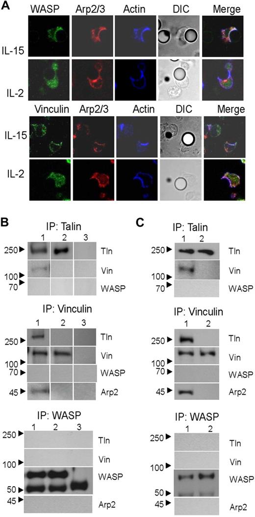 Figure 4. Vinculin constitutively associates with talin and Arp2. (A) IL-15– or IL-2–activated splenic NK cells were incubated with ICAM-1 beads, fixed, permeabilized, and stained for WASP or vinculin (green), Arp2/3 (red), and actin (blue). Alexa Fluor 488 secondary antibody was used for WASP and vinculin staining, and Alexa 568 secondary antibody was used for Arp2/3 staining. Actin was stained with Alexa 647–conjugated phalloidin. Images (× 400 magnification) were collected by confocal microscopy as in Figure 1. (B) IL-15– (lane 1) or IL-2–cultured (lane 2) splenic NK cells were lysed. Immunoprecipitation was performed with anti-talin (top), anti-vinculin (center), anti-WASP (bottom), or isotype control antibodies (lane 3) and probed as indicated. Immunoprecipitates were blotted as indicated. Results shown are representative of 3 independent experiments. (C) IL-15– (lane 1) or IL-2–activated (lane 2) splenic NK cells were allowed to bind to ICAM-1–coated plates and then lysed. Immunoprecipitation was performed with anti-talin (top), anti-vinculin (center), or anti-WASP (bottom) and probed as indicated. In the WASP immunoprecipitates in panels B and C, IgG (∼ 50 kD) band is also detected.