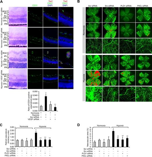 Figure 7. Down-regulation of VEGF, Src, PLD1, or PKCγ blocks hypoxia-induced retinal neovascularization. (A) After exposure to 75% oxygen, the mice pups were returned to normoxia, administered 1 μg of Scr or VEGF siRNA at P12 and P13 by intravitreal injections, and retinas were isolated at P15 and analyzed by double immunofluorescence staining for CD31 and Tie2 (top panel). Retinal vascularization was quantified by measuring the ratio of CD31-positive area to retinal area (bottom panel). The left column shows the histochemical staining of the respective retinal sections. The far right column shows the higher magnification (original magnification ×40) of retinal sections shown in the third column. (B-D) After exposure to 75% oxygen, the mice pups were returned to normoxia, administered 1 μg of Scr, Src, PLD1, or PKCγ siRNA at P13, P14, and P15 by intravitreal injections, and at P17 pups were anesthetized, perfused with FITC-dextran, sacrificed, enucleated, retinas were isolated, and flat mounts of whole retina were examined for retinal neovascularization (B). Neovascular tufts were highlighted with red (second and fifth rows). The third and sixth rows show the magnified section of a selected area of the images shown in the first and third rows, respectively. The images were captured using an Inverted Zeiss fluorescence microscope (AxioVision AX10), and fluorescence intensity in the total retinal area (C) and the area of neovascular tufts to total retinal area (D) was analyzed by Nikon NIS-Elements software Version AR3.1. Values are mean ± SD. *P < .01 versus normoxia plus scrambled siRNA control. **P < .01 versus hypoxia plus scrambled siRNA. RGC indicates retinal ganglion cell; IPL, inner plexiform layer; INL, inner nuclear layer; OPL, outer plexiform layer; ONL, outer nuclear layer; and PR, photoreceptors.