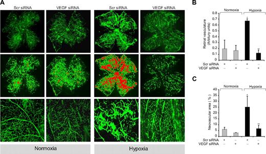 Figure 8. Depletion of VEGF levels reduces hypoxia-induced retinal neovascularization. After exposure to 75% oxygen, the mice pups were returned to normoxia and administered 1 μg of Scr or VEGF siRNA at P13, P14, and P15 by intravitreal injections. Pups were anesthetized at P17, perfused with FITC-dextran, sacrificed, enucleated, retinas were isolated, and flat mounts of whole retina were examined for retinal neovascularization (A). Neovascular tufts were highlighted with red (second row). The third row shows the magnified (original magnification ×10) section of a selected area of the images shown in the first row (original magnification ×2). The images were captured using an Inverted Zeiss fluorescence microscope (AxioVision AX10), and fluorescence intensity in the total retinal area (B) and the area of neovascular tufts to total retinal area (C) was analyzed by Nikon NIS-Elements software Version AR3.1. Values are mean ± SD. *P < .01 versus normoxia plus scrambled siRNA control. **P < .01 versus hypoxia plus scrambled siRNA.