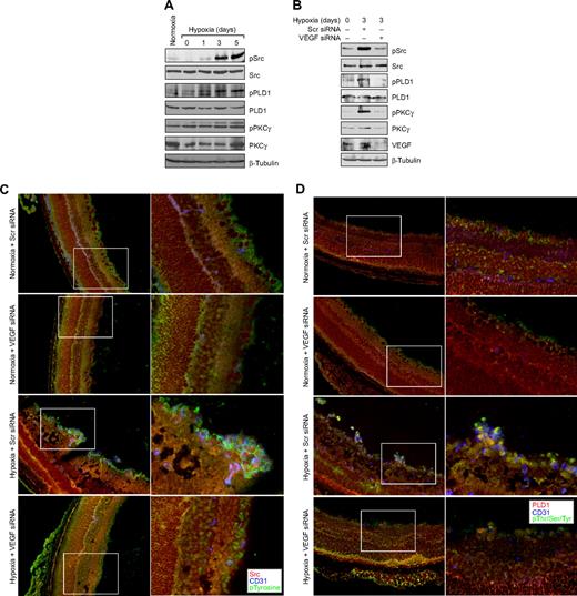 Figure 6. Hypoxia stimulates Src, PLD1, and PKCγ phosphorylation in a VEGF-dependent manner in retina. (A) C57BL/6 mice pups were exposed to 75% oxygen from P7 to P12, at which time they were returned to normoxia for the indicated time periods, enucleated, retinas were isolated, and analyzed by Western blotting for Src, PLD1, and PKCγ phosphorylation using their phosphospecific antibodies. (B) After exposure to hyperoxia, pups were returned to normoxia and administered 1 μg of Scr or VEGF siRNA at P12 and P13 by intravitreal injections. Retinas were isolated at P15, and the proteins were analyzed by Western blotting for Src, PLD1, and PKCγ phosphorylation using their phosphospecific antibodies. The blots were reprobed with antibodies of the indicated molecules for normalization. The blots in panels A and B that were probed with phosphospecific anti-PKCγ antibodies were also reprobed with either anti–β-tubulin or anti-VEGF antibodies for the purpose of lane loading control or to show the effect of VEGF siRNA on VEGF levels. (C) Retinas isolated at P15 were analyzed by double or triple immunofluorescence staining for phosphorylation of Src (C), PLD1 (D), and PKCγ (E) along with CD31 as described in “Methods.” The right column shows the higher magnification (original magnification ×40) of the selected areas of images shown in the left column.