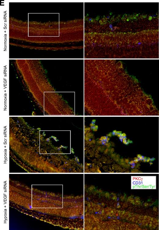 Figure 6. Hypoxia stimulates Src, PLD1, and PKCγ phosphorylation in a VEGF-dependent manner in retina. (A) C57BL/6 mice pups were exposed to 75% oxygen from P7 to P12, at which time they were returned to normoxia for the indicated time periods, enucleated, retinas were isolated, and analyzed by Western blotting for Src, PLD1, and PKCγ phosphorylation using their phosphospecific antibodies. (B) After exposure to hyperoxia, pups were returned to normoxia and administered 1 μg of Scr or VEGF siRNA at P12 and P13 by intravitreal injections. Retinas were isolated at P15, and the proteins were analyzed by Western blotting for Src, PLD1, and PKCγ phosphorylation using their phosphospecific antibodies. The blots were reprobed with antibodies of the indicated molecules for normalization. The blots in panels A and B that were probed with phosphospecific anti-PKCγ antibodies were also reprobed with either anti–β-tubulin or anti-VEGF antibodies for the purpose of lane loading control or to show the effect of VEGF siRNA on VEGF levels. (C) Retinas isolated at P15 were analyzed by double or triple immunofluorescence staining for phosphorylation of Src (C), PLD1 (D), and PKCγ (E) along with CD31 as described in “Methods.” The right column shows the higher magnification (original magnification ×40) of the selected areas of images shown in the left column.
