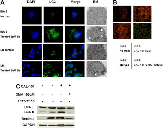 Figure 4. CAL-101 induces autophagy. (A) INA-6 and LB MM cells were treated with 5μM CAL-101 for 6 hours. CAL-101 treatment induced LC3 accumulation in LB and INA-6 cells, evidenced by fluorescence microscopy or transmission electron microscopy. Autophagosome formation was defined by the accumulation of LC3; arrows indicate autophagosomes. (B) INA-6 cells were treated with 5μM CAL-101 or serum starvation for 6 hours with or without 100μM 3-MA, stained with 1 μg/mL acridine orange for 15 minutes, and analyzed by fluorescence microscopy. (C) LC3 and beclin-1 protein levels were determined by Western blotting using LC3 and beclin1 Abs of lysates from INA-6 cells treated with CAL-101, with or without 3-MA. GAPDH served as a loading control.