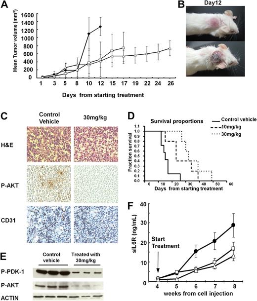 Figure 6. In vivo efficacy of IC488743 treatment of human MM xenografts in SCID mice. (A) Mice injected with 5 × 106 LB cells were treated orally twice a day with control vehicle (●), and IC488743 10 mg/kg (□) or 30 mg/kg (○). Mean tumor volume was calculated as in “Murine xenograft models of human MM.” Error bars represent SD. (B) Representative whole-body images from a mouse treated for 12 days with control vehicle (top panel) or IC488743 (30 mg/kg; bottom panel). (C) Tumors harvested from IC488743 (30 mg/kg) treated mouse (right panel) and control mouse (left panel) were subjected to immunohistochemical analysis using CD31 and P-AKT Abs. CD31 and P-AKT positive cells are dark brown. (D) Mice were treated with IC488743 10 mg/kg (hyphenated line), 30 mg/kg (dotted line), or control vehicle (solid line). Survival was evaluated from the first day of treatment until death using Kaplan-Meier curves. (E) Tumor tissues were harvested from mice treated with control vehicle or IC488743 (30 mg/kg). Protein levels of phosphorylated of PDK-1 and AKT (Ser473) were determined by Western blotting of cell lysates. Actin was used as a loading control. (F) Growth of INA-6 cells engrafted in human bone chips in SCID mice was monitored by serial serum measurements of shuIL-6R. Mice were treated with IC488743 10 mg/kg (□), 30 mg/kg (▵), or control vehicle (●), and shuIL-6R levels were determined weekly by ELISA. Error bars represent SD.