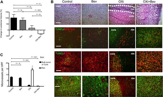Figure 1. Effects of OXi4503 and bevacizumab on subcutaneous leukemic chloromas. NOD/scid/IL2Rγ−/− (NOG) mice were subcutaneously inoculated with KG-1 human acute myelogenous leukemia (AML) cells. After chloromas were palpable mice were treated with intraperitoneal injections of bevacizumab, OXi4503, combination (OXi+Bev), or controls. Leukemia growth was measured every other day. (A) OXi4503 alone decreased leukemia growth in comparison to controls. Combination Oxi4503+Bev treatment resulted in regression of cancer size. Bevacizumab alone had no effect on tumor growth. (B) Comprehensive staining of chloromas was performed for: H&E (scale bar: 200 μm), TUNEL/MECA-32 (scale bar: 100 μm), (TUNEL/CD45 (scale bar: 50 μm), and CD45/VEGF-A (scale bar: 100 μm). Sections showed that OXi4503 monotherapy led to chloromas with central cores made up mainly of nonvascularized, TUNEL+ apoptotic cells and viable rims (outlined by dotted lines) containing MECA-32+ blood vessels at the periphery of leukemias. VEGF-A expression was also observed in viable rims. Combination therapy eliminated the viable rim resulting in widespread apoptosis and a lack of intact blood vessels throughout the tumor mass. Bevacizumab-treated tumors showed no difference in staining compared with controls. (C) Quantification of microvessels based on MECA-32+ blood vessels revealed decreased density within leukemic cores of mice treated with OXi4503 and combination therapy in comparison to bulk control tumors. Blood vessels within viable leukemia rims are increased after OXi4503 treatment but significantly decreased with additional bevacizumab treatment. Values represent mean ± SEM. *P < .05.
