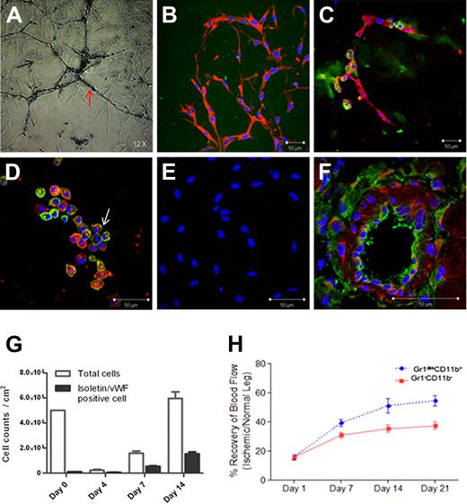 Figure 2. Cell culture and in vivo transplantation of muscle-derived Gr1dimCD11b+ and Gr1−CD11b− cells. (A) Images of cultured Gr1dimCD11b+ cells 4 days after in Matrigel. (B-C) Immunofluorescence of cultured Gr1dimCD11b+ cells with anti–rabbit GFAP antibody (red) and isolectin (green) 4 days after in Matrigel. (D) Immunofluorescence of cultured Gr1dimCD11b+ cells with anti–rabbit von Willebrand Factor (VWF) antibody (arrow; red) and isolectin (green) 4 days after in Matrigel. (E) No isolectin and VWF expressions were observed in cultured Gr1−CD11b− cells. (F) Red fluorescent signals indicate localization of transplanted C57BL/6 derived Gr1dimCD11b+ cells (CD45.2). Ten days after cell injection, CD45.2 positive cells were present in the vascular wall of the vessels of Boy/J mice. (G) Growth of Gr1dimCD11b+ cells in Matrigel culture. Total cells and isolectin/VWF double positive cells were counted at the indicated times. Quantitative analysis of hind-limb perfusion; (H) LDP index was significantly higher in the Gr1dimCD11b+ cells (5 × 105 cells /mouse) injected group compared with the control group injected with Gr1− CD11b− cells (5 × 105 cells /mouse) 3 weeks after cell injection. Data are mean ± SEM; P = .003.