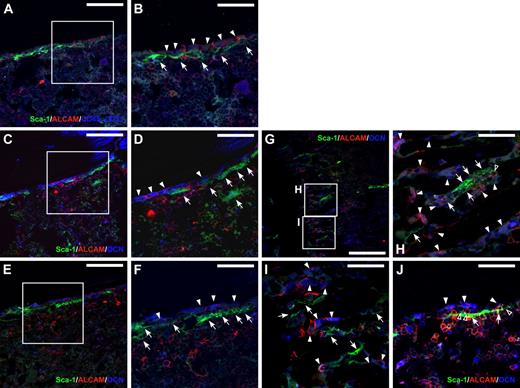Figure 2. Localization of ALCAM+ and Sca-1+ cells in BM. (A and B) Immunohistochemical staining of ALCAM (red), Sca-1 (green), and CD45, CD31 (blue) in adult mouse BM. CD45−/CD31− ALCAM+ cells (arrowheads) and flat-shaped Sca-1+ cells (arrows) were localized to the endosteum. (B) Greater magnification of the enclosed box in panel A. Scale bar: 100 μm (A), 50 μm (B). (C-J) Immunohistochemical staining of ALCAM (red), Sca-1 (green), and OCN (blue) in adult mouse BM. Multiple views of the trabecular bone surface are shown. (C-F) Diaphysial region. (G-I) Metaphyseal region. A portion of OCN-positive osteoblastic cells expressed ALCAM on the bone surface in the trabecular area (arrowheads). In addition, flat-shaped Sca-1+ cells were also localized to the endosteal surface (arrows). Of note, there were no bone-lining nonhematopoietic cells that expressed both ALCAM and Sca-1. (D and F) Greater magnification of the enclosed box in panels C and E, respectively. (H and I) Greater magnification of the enclosed box in panel G. (J) Some of ALCAM+Sca-1+ hematopoietic cells (open arrowheads) adhered to the OCN+ALCAM+Sca-1− cells (arrows) and OCN−ALCAM−Sca-1+ cells (arrow). Scale bar: 200 μm (G), 100 μm (C,E), and 50 μm (D,F,H-J).