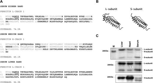 Figure 2. Full-length L- and H-subunits and a truncated L-subunit are detected in serum ferritin. (A) The main ferritin peak from Figure 1B was concentrated and separated on sodium dodecyl sulfate–polyacrylamide gel electrophoresis (SDS-PAGE). Alternatively, serum ferritin was immunoprecipitated and separated on SDS-PAGE. Relevant protein bands were analyzed by LC-MS/MS mass spectrometry. Black-labeled amino acid sequences were detected by MS, showing the presence of L-, H- and a truncated L-subunit. L-subunit contains 1 potential site for N-glycosylation at the N-terminus of the protein (underlined) that faces the exterior surface of the assembled protein (determined by comparison to the human 24 subunit assembled structure; http://www.ncbi.nlm.nih.gov/Structure/CN3D/cn3d.shtml). (B) The structure of the L-subunit sequences was predicted using the Swiss Model Web site (http://www.ebi.ac.uk/swissprot). The truncated L- ferritin lacks the entire fifth short helix at the C-terminal end of the protein. (C) Top panel: Coomassie staining of immunoprecipitated liver, heart, and serum ferritin from iron-overloaded mice detects L-subunit very clearly while H-subunit in serum is hardly detectable. A 17-kD band (marked) S-subunit is prominent in serum (1 representative experiment is shown of 5). Middle and bottom panels: Immunoprecipitation of 5 μg of liver, heart, and serum ferritin with an anti–mouse liver ferritin antibody followed by Western blot with the same anti–liver antibody (middle panel) or with an anti–H-subunit antibody (bottom panel) shows that serum ferritin contains many fewer H-subunits than liver and heart ferritin (1 representative experiment is shown of 3 for L ferritin Western and of 6 for H-ferritin Western). It is important to note that in contrast to human ferritin, mouse L-ferritin subunits migrate at around 21 kD and H-ferritin subunits migrate slightly faster.