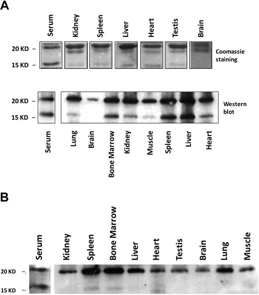 Figure 5. Serum ferritin is characterized by a high representation of the 17-kD truncated subunit of the L-chain. (A) Serum or tissue-lysates from iron-dextran overloaded mice were subjected to IP, using an anti–liver ferritin antibody (Serum, 20 μg ferritin/IP; liver lysate, 200 μg protein/IP; and all other tissue lysates, 1 mg protein/IP). IPs were separated on SDS-PAGE and stained with Coomassie (top panel; 1 representative experiment is shown of 4). Western blot with anti–liver ferritin antibody from tissue-lysates (40 μg protein/IP) and immunoprecipitated serum from iron-dextran overloaded mice (bottom panel; 1 representative experiment is shown of 3). (B) Western blot as in panel A from tissue lysates (40 μg protein/lane) and serum (200 ng of ferritin/IP) from untreated mice (1 representative experiment is shown of 3).