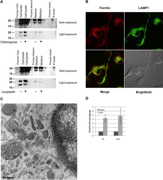 Figure 6. Macrophages actively secrete ferritin. (A) BMDMs were incubated with 15μM chloroquine or 80 μg/mL leupeptin for 18 hours. Ferritin was immunoprecipitated from cell lysates and medium, separated on SDS-PAGE and detected by Western blot with the anti–L-subunit antibody. For each experiment, 1 representative gel is shown of 4 similar experiments. (B) BMDM immunofluorescence of ferritin and LAMP1. Image visualization was made on a Zeiss LSM 510 META laser scanning confocal microscope with a Plan-Apochromat 63×/1.4 oil DIC lens and scan zoom 2.0, resulting in a final magnification of ×126. Alexa Fluor 488 and 568 were used as fluorochromes. Images were captured using LSM5 software program and further processed with Adobe Photoshop. (C) Electron microscopy (EM) analysis of BMDMs. L indicates lysosome; AL, autophagolysosome; M, mitochondria; ER, endoplasmic reticulum; and N, nucleus. Sections were examined with a T12 transmission electron microscope at 120keV (FEI). Image acquisition was done using a 2k CCD ultrascan CCD camera (Gatan). (D) Comparison of ratio of ferritin-Fe55/ferritin-protein showed that the radioactive iron content of the secreted ferritin was significantly lower than that of the intracellular ferritin. BMDMs were incubated overnight with transferrin-Fe55. Ferritin protein and Fe55 content was determined in lysates and medium by immunoprecipitation followed either by Western blot with a purified ferritin standard curve for protein quantification or scintillation counting for Fe55 determination.