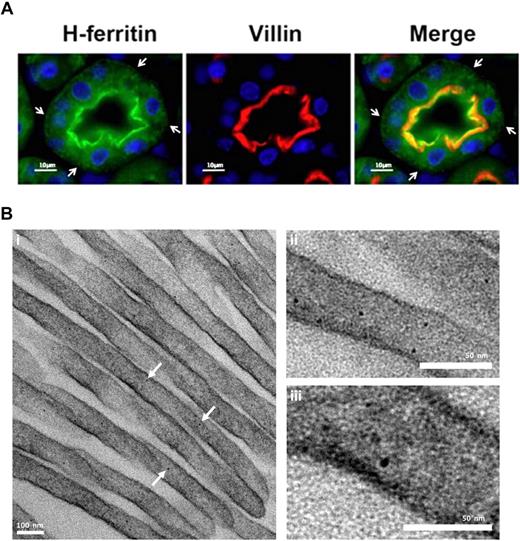 Figure 7. Structured subcellular localization of ferritin in proximal tubule brush border cells. (A) Immunofluorescence of kidney cortex sections using antibodies against H ferritin (green) and villin (red). Nuclei were stained with DAPI (blue). H ferritin and villin showed colocalization near the brush border region of proximal convoluted tubule cells. Ferritin concentration decreased toward the basolateral membrane of the cell and distribution showed a punctate pattern. Vesicle-like structures are visible at the basolateral membrane (arrowheads). Villin is an actin-binding protein found exclusively in the brush border of renal and intestinal epithelial cells. Experiments with an L-subunit–specific antibody gave similar results. Image visualization was made on a Nikon Eclipse E600 using a 63× magnification. CY3 and FITC were used as fluorochromes. Images were captured using a Nikon Digital Camera DXM1200F with Nikon ACT-1 Version 2.62 software. Images were processed with Adobe Photoshop. (B) Kidney cortex EM: Electron-dense particles of 5 to 7 nm in diameter that have clear characteristics of ferritin–iron cores are abundant in the proximal tubule brush border. Kidney cortex specimens were fixed with 2.5% glutaraldehyde and reduced osmium, followed by dehydration and embedding in Epon resin. Finally, microtome sections were mounted on copper grids and stained with bismuth subnitrate before visualization on a Technai T12 TEM at 120keV (FEI). Image acquisition was done using a 2k CCD ultrascan CCD camera (Gatan). Arrows denote electron dense ferritin particles.