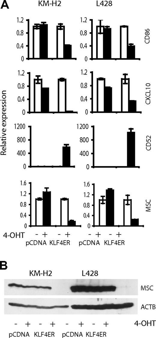 Figure 7. Validation of array-based gene expression profiles. (A) Quantitative PCR. (B) Immunoblot. Expression of CD86, CXCL10, CD52, and MSC was determined in KM-H2 and L428 cells, expressing KLF4-ER or empty vector, treated and not treated with 200nM of 4-OHT. After 24 hours of incubation with 4-OHT, cells were harvested. mRNA expression was determined by quantitative PCR and calculated in relation to internal control gene RPL13A by the comparative Ct method. Mean value of the group expressing empty vector and not activated with 4-OHT was used as comparator. Data are mean ± SD.