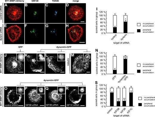 Figure 2. Transport of MT1-MMP along microtubules is driven by dynein and kinesins. (A-I) Dynein siRNA leads to peripheral accumulation of MT1-MMP and to Golgi dispersal. Confocal micrographs of primary human macrophages expressing MT1-MMP–mCherry (A,E), transfected with control siRNA (A-D) or dynein siRNA (E-H), and stained for Golgi markers GM130 (B,F) and TGN46 (C,G). (D,H) Merged images. Note peripheral accumulation of MT1-MMP–mCherry (E) and dispersed appearance of Golgi (F-G) upon dynein siRNA treatment. (I) Evaluation of MT1-MMP–mCherry distribution upon transfection with control siRNA or siRNA against dynein. For each value, 3 × 30 cells were evaluated. Note enhanced percentage of cells with peripheral accumulation of MT1-MMP–mCherry in case of dynein siRNA treatment. Asterisk indicates value significantly different from controls (P < .05). For specific values, see supplemental Table 1. (J-N) Retrograde movement of MT1-MMP depends on dynein. Still images of confocal time-lapse videos of macrophages expressing MT1-MMP–mCherry and coexpressing GFP (J) or dynamitin-GFP for inhibition of dynein (K-L; supplemental Video 6), as indicated in detail images. Note pronounced peripheral accumulation of MT1-MMP–mCherry upon dynein inhibition in (K-L), mostly accompanied by reduction (K) or disappearance (L) of the central accumulation (supplemental Video 6). (M) Confocal micrograph of macrophage expressing dynamitin-GFP and stained for β-tubulin by specific primary and Alexa 488–labeled secondary antibody. Note intact microtubule system in case of dynamitin-GFP overexpression. (N) Evaluation of intracellular MT1-MMP–mCherry distribution upon overexpression of dynamitin-GFP or GFP control. For each value, 3 × 30 cells were evaluated. Note increased percentage of cells with peripheral accumulation of MT1-MMP–mCherry upon overexpression of dynamitin-GFP. **P < .001 compared with control. (O-S) Anterograde movement of MT1-MMP depends on KIF5B and KIF3B kinesins. Confocal images of macrophages expressing MT1-MMP–mCherry and coexpressing dynamitin-GFP, as indicated in detail images. Cells were treated with siRNA against control sequence (O), KIF5B (P), KIF3B (Q), or KIF1C (R). Note pronounced peripheral accumulation of MT1-MMP–mCherry upon dynein inhibition in control cells treated with control siRNA (O). This effect is inhibited by treatment with siRNA directed against KIF5B (P), KIF3B (Q), but not KIF1C (R). (S) Evaluation of cells showing peripheral accumulation of MT1-MMP–mCherry upon overexpression of dynamitin-GFP and treatment with various siRNAs. For each value, 3 × 30 cells were evaluated. **P < .001 compared with control. White scale bars indicate 10 μm.