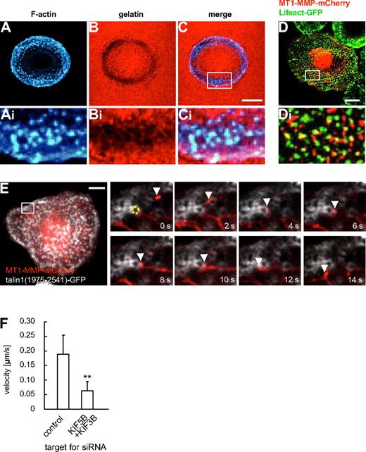 Figure 6. Podosomes are sites of matrix degradation and are contacted by MT1-MMP–mCherry vesicles. (A-F) Confocal micrographs of a macrophage seeded on rhodamine-labeled gelatin matrix, F-actin labeling podosome cores stained with Cy5-labeled phalloidin (A,Ai), gelatin matrix in red (B,Bi), merged images (C,Ci). White box in (C) indicates region enlarged in (Ai,Bi,Ci). (D) Confocal micrograph of primary human macrophage expressing MT1-MMP–mCherry and GFP-coupled Lifeact, staining F-actin-rich podosome cores. White box in (D) indicates region shown enlarged in (Di). Note close proximity between MT1-MMP–mCherry vesicles and podosome cores. (E) Still images from time-lapse video (supplemental Video 7). Macrophage expressing MT1-MMP–mCherry and a C-terminal talin1-GFP construct labeling podosome ring structures. White box in larger image indicates region shown in detail images. A podosome (labeled by dotted yellow ring) is contacted by a MT1-MMP-mCherry vesicle (white arrowhead) for approximately 10 seconds. Time in seconds is indicated in lower right corners. White scale bars indicate 10 μm. (F) Velocity of MT1-MMP–mCherry vesicles in the vicinity of podosomes. Bar diagram shows velocities in micrometers per second for vesicles moving along podosome rings in macrophages treated with control siRNA or 2 siRNAs specific for KIF5B and KIF3B (n = 17, respectively). **P < .01 compared with control. For specific values, see supplemental Table 1. Bars indicate mean values ± SD.