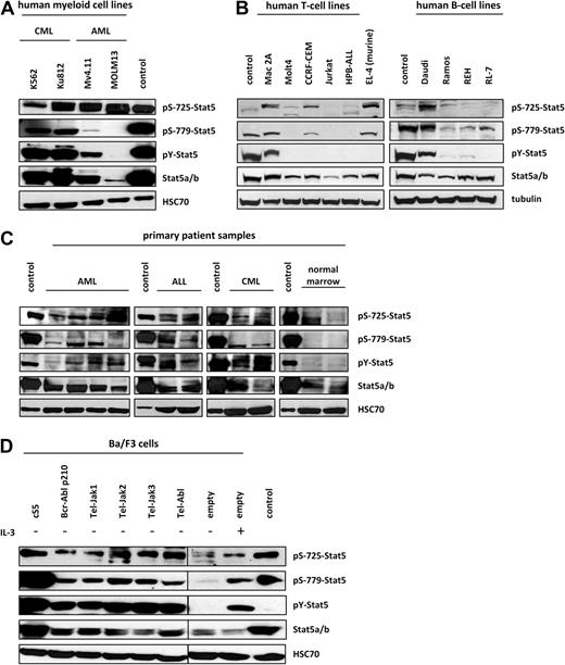 Figure 1. Ser725/779 residues are significantly phosphorylated in transformed cell lines and primary samples from leukemia patients. (A) The C-terminal serine residues 725 and 779 of Stat5a were found to be considerably phosphorylated in human leukemic cell lines. K562 and Ku-812 were used as representative CML samples, and Mv4.11 and MOLM13 for AML. In Western blot analysis, Ser779 was found to be phosphorylated predominantly in CML samples, whereas Ser725 phosphorylation (Abcam antibody) was detected in all leukemia cell lines. S5-expressing gpE+86 fibroblasts served as controls. A representative blot of 3 independent experiments was chosen. (B) Different transformed human T- and B-cell lines, Mac-2A (CTCL), MOLT-4, CCRF-CEM, Jurkat, HPB-ALL (all T-ALL), as well as DAUDI and RAMOS cells (Burkitt-lymphoma), REH (B-ALL), and RL-7 (non-Burkitt lymphoma) cell lines were analyzed for serine phosphorylation by Western blot analysis. Daudi cells as well as CCRF-CEM and Mac-2A cells were found to be strongly positive for Ser725 (Eurogentech and Abcam) and Ser779 phosphorylation. Whereas Mac-2A, Daudi, and to a lesser extent Ramos and REH cells showed Ser779 phosphorylation in addition to Tyr-phosphorylation, Ser779 phosphorylation was largely independent of Tyr-phosphorylation in CCRF-CEM and RL-7 cells. In all B-cell lines except Daudi cells, Ser725 phosphorylation was very low but clearly detectable. A murine T-cell lymphoma line (EL-4) was included in the analysis; it was positive for Ser779 phosphorylation, which was independent of Tyr-phosphorylation. The CML line K562 was used as positive control. Similar results were obtained in 3 individual experiments. (C) Protein analysis of primary samples from AML (n = 4), ALL (n = 2), and CML (n = 2) patients as well as from healthy individuals (n = 2) revealed that Stat5a and Stat5b are strongly phosphorylated not only at the critical tyrosine 694 residue, but also at serine 725, and Stat5a additionally at serine 779. Serine 779 phosphorylation was not detected in healthy individuals, whereas serine 725 was found to be phosphorylated in all samples tested. GpE+86 cells expressing S5 were used as controls for all analyses. The experiments were performed in duplicate. (D) Ba/F3 cells were engineered by retroviral transduction to overexpress the cS5 variant as well as fusion kinases, which are known to activate Stat5a and Stat5b in human patients. Modified Ba/F3 cells were subjected to immunoblot analysis to evaluate Stat5 tyrosine and serine phosphorylation. Ser725 (Abcam antibody) and Ser779 were strongly phosphorylated in all factor-independent lines. Parental Ba/F3 cells starved for 20 hours and cells restimulated with IL-3, as well as S5-expressing gpE+86 fibroblasts, served as controls (exposed on the same blot; interjacent bands were cut). The blots are representatives of 4 individual experiments.