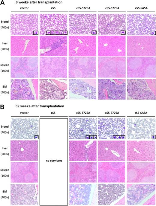 Figure 6. Alterations of organotypic structures in cS5-transplanted mice and cS5 serine mutants. (A) At 8 weeks after BM transplantation, histopathologic analysis of PB, liver, spleen, and BM revealed signs of leukemia in cS5-transplanted mice, including elevated numbers of myeloid and lymphoid cells in the PB and disruption of spleen germinal center architecture with concomitant splenomegaly. In addition, the liver portal tracts and parts of the liver parenchyma in these mice were diffusely infiltrated by hematopoietic cells. Blast-like cells were detected in the BM. Contrary, mice transplanted with cS5 serine mutants did not show any abnormalities and histologically resembled the GFP vector controls. (B) At 32 weeks after transplantation, mice transplanted with cS5 single-serine mutants showed increased numbers of lymphoid cells in PB, with cS5-S725A–transplanted mice displaying a stronger phenotype characterized by disruption of the splenic architecture and infiltration of the liver by hematopoietic cells. cS5-SASA–transplanted mice did not show any signs of disease throughout the period of analysis. For each transplant group, a minimum of 8 mice was analyzed, which all displayed similar histologic features (magnifications: spleen ×100, liver ×200, BM and blood smear ×400).