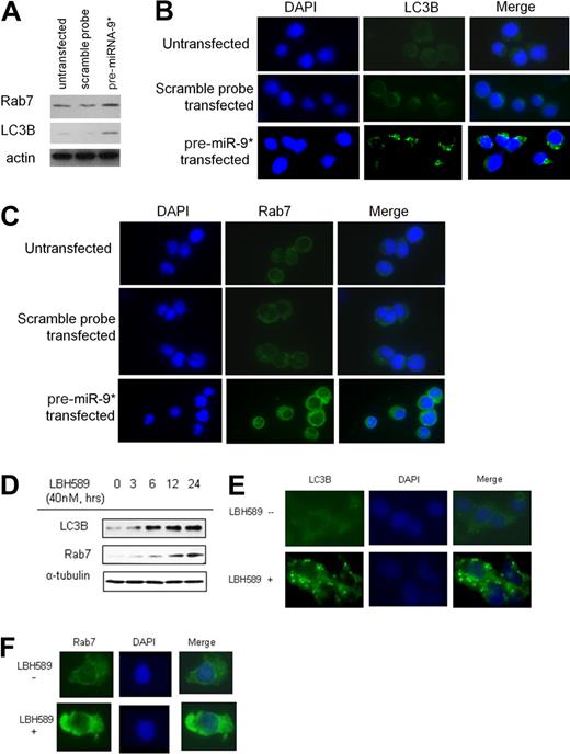 Figure 6. miRNA-9*–dependent HDAC inhibition and modulation of autophagy in WM cells. (A) BCWM.1 cells (untransfected, scramble probe–,and pre-miRNA-9*–transfected) were harvested at 24 hours after transfection. Whole-cell lysates were subjected to Western blot with the use of anti-Rab7, -LC3, and -actin antibodies. (B) BCWM.1 cells were cultured with LBH589 (40nM) for 0 to 24 hours. Whole-cell lysates were subjected to Western blotting with the use of anti-Rab7 and -LC3B antibodies. (C-D) BCWM.1 cells were cultured in the presence or absence of LBH589 (40nM) for 16 hours. Immunocytochemical analysis was assessed with the use of anti-Rab7 (C) or -LC3B (D) antibodies. DAPI indicates 4′-6′-diamidine-2-phenylindole.