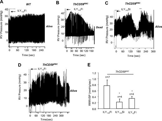 Figure 2. ILY140FI-induced death in ThCD59RBC mice associated with a significantly lower RRRVSP compared with ILY140SI or ILY70FI. (A-D) Representative tracings show the dynamic changes in RVSP in the WT (A) and ThCD59RBC mice with ILY140FI (B), and the ThCD59RBC mice with ILY140SI (C) and ILY70FI (D). (E) RRRVSP comparison among these mice. RRRVSP (mm Hg/s) = increased systolic pulmonary arterial pressure (in mm Hg)/time (in seconds; black line in panel B). RRRVSP t test. *P < .05 vs ThCD59RBC mice with ILY140FI. Results represent mean ± SEM.