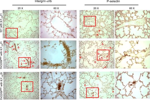 Figure 5. Representative images of integrin αIIb and P-selectin staining in lung. There is more extensive integrin αIIb and P-selectin staining (arrows) in small perialveolar blood vessels in the lungs of ThCD59RBC mice treated with ILY140FI than in those treated with ILY140SI. Platelet aggregates were adherent to the vessel walls in the ThCD59RBC mice treated with ILY140FI; this is evident in the 60× magnified images. WT mouse lungs had no or very little staining. Lower magnification (4× and 10×) images for P-selectin staining of the different mice are shown in supplemental Figure 3.