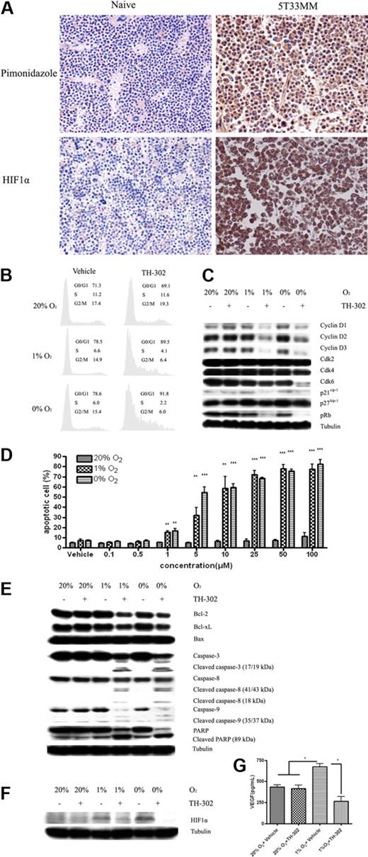 Figure 1. The hypoxia status of the BM and the in vitro effects of TH-302 on MM cells. (A) Immunohistochemistry staining of exogenous hypoxia marker and endogenous hypoxia marker in BM sections of naive and 5T33MM mice. Hypoxia was determined by the accumulation of pimonidazole and HIF-1α as described in supplemental Methods. Original magnification, × 40. Representative pictures, n = 6/group. (B) TH-302 induces G0/G1 cell-cycle arrest in 5T33vt cells in a hypoxia-selective manner. Similar results were also found in RPMI-8226, LP-1, MMS1, and Karpas-707 MM cells (data not shown). (C) Effects of TH-302 on components of the 5T33vt MM cell-cycle machinery. TH-302-induced G0/G1 cell-cycle arrest depends on down-regulating cyclin D1/2/3, CDK4/6, p21, p27, and pRb expression. Similar results were also found in RPMI-8226, LP-1, MMS1, and Karpas-707 MM cells (data not shown). (D) TH-302 triggers specific apoptosis in a dose-dependent manner in LP-1 cells under hypoxia. *P < .05, **P < .01, ***P < .001, compared with 20% O2 (n = 3). Similar results were also seen with RPMI-8226, 5T33vt, MMS1, and Karpas-707 cells (data not shown). (E) The mechanism of TH-302-induced apoptosis in LP-1 cells. Similar results were also found in RPMI-8226, 5T33vt, MMS1, and Karpas-707 cells. TH-302 = 5μM. (F) TH-302 decreases the accumulation of HIF-1α in hypoxic RPMI-8226 cells. Similar results were also found in 5T33vt, LP-1, MMS1, and Karpas-707 cells (data not shown). TH-302 = 5μM. (G) VEGFa secretion was reduced by TH-302 in 5T33vt cells. *P < .05. n = 3.