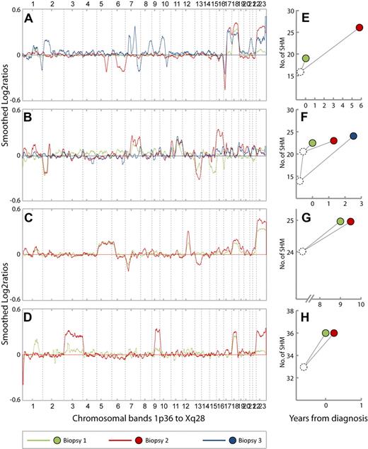 Figure 4. CNA profiles and patterns of SHMs from 4 representative cases. (A-D) CNA profiles from cases 34, 5, 26, and 28, respectively. The chromosomes 1 to 22 and X are aligned along the x-axis from 1p36 to Xq28. Y-axis; smoothed log2 ratios, k = 29. Green, red, and blue lines represent the CNA profiles in biopsy 1, 2, and 3 from each patient, respectively. (E-H) Patterns of somatic hypermutations (SHMs) in samples from cases 34, 5, 26, and 28, respectively. Green, red, and blue dots represent biopsy 1, 2, and 3, respectively. The position of the dots along the x-axis represent the time point at which the biopsies were obtained relative to primary diagnosis (t = 0). Y-axis; number of SHMs. (A) Case 34. Biopsy 1 = FL grade 1 (t = 0). Biopsy 2 = FL grade 2 (t = 5.7). Biopsy 3 = FL grade 3a (t = 6.8). Gain of 18 is present in all 3 biopsies. Losses on 5q and 6q in biopsy 2 are absent in biopsy 3, whereas several new CNAs also appear in biopsy 3. (B) Case 5. Biopsy 1 = FL grade 1 (t = 0). Biopsy 2 = DLBCL (t = 1.2). Biopsy 3 = FL grade 2 (t = 2.4). Gain of 11q is present in all 3 biopsies. Losses of 15 and 17p in biopsy 1 are absent in biopsy 2. Losses of 2p and 13 and gains of 2p, 7q, and 16 in biopsy 2 are absent in biopsy 3. (C) Case 26. Biopsy 1 = FL grade 2 (t = 9). Biopsy 2 = FL grade 3a with marginal zone differentiation (t = 9.4). Loss of 13 appears in biopsy 2. (D) Case 28. Biopsy 1 = FL grade 1 (t = 0). Biopsy 2 = FL grade 1, (t = 0. 1). Gains of chromosome 3 and 9 in biopsy 2 are barely seen in biopsy 1. (E). Case 34. Sixteen mutations are common for biopsies 1 and 2, whereas 3 and 10 additional mutations, respectively, are unique. (F) Case 5. Biopsies 1 and 2 have 21 mutations in common in addition to 1 unique mutation each. Biopsy 3 has 14 mutations in common with the 2 preceding samples in addition to 13 unique mutations. (G) Case 26. Biopsies 1 and 2 have 24 mutations in common and 1 unique mutation each. (H) Case 28. Biopsies 1 and 2 have 33 mutations in common and 3 unique mutations each.
