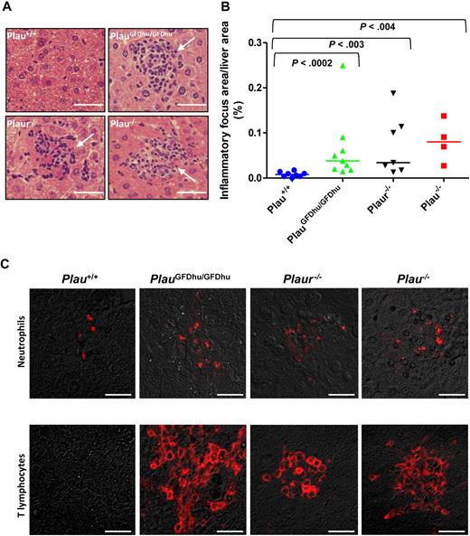 Figure 4. Chronic inflammation caused by abrogation of uPA-uPAR interaction. (A) Histologic appearance of the livers of 1-year-old Plau+/+ (top left panel), PlauGFDhu/GFDhu (top right panel), Plaur−/− (bottom left panel), and Plau−/− (bottom right panel) mice. Focal leukocyte infiltrates (examples with arrows) are increased in mice with abrogated uPA-uPAR interaction, loss of uPAR, or loss of uPA. Size bars, 50 μm. (B) Enumeration of inflammatory foci in the livers of Plau+/+ (left), PlauGFDhu/GFDhu (second left), Plaur−/− (second right), and Plau−/− (right) mice. Symbols represent individual mice. Horizontal bars show average values. P values were determined by the Mann-Whitney U test, 2-tailed. (C) Examples of immunostaining for neutrophils (myeloperoxidase, top panels) and T lymphocytes (CD3, bottom panels) within inflammatory foci from Plau+/+ (left panels), PlauGFDhu/GFDhu (second panels from left), Plaur−/− (second panels from right), and Plau−/− (right panels) showing prominent infiltration of neutrophils and T lymphocytes into tissues from mice with abrogated uPA-uPAR interaction, but not into mice with unchallenged uPA-uPAR interaction. Size bars, 20 μm.