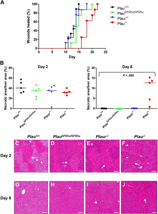 Figure 6. Loss of uPA binding to uPAR does not affect tissue repair. (A) Rate of healing of 1.5-cm incisional skin wounds in Plau+/+ (black, N = 10), PlauGFDhu/GFDhu (green N = 10), Plaur−/− (blue, N = 10), and Plau−/− (red, N = 9) mice. Loss of uPA, but not uPA binding, to uPAR or loss of uPAR delays wound healing. P < .001 Plau−/− versus Plau+/+, PlauGFDhu/GFDhu or Plaur−/−, log-rank test, 2-tailed. (B) Area of hepatic necrosis 2 (left panel) and 8 (right panel) days after carbon tetrachloride–induced liver injury of Plau+/+ (black circles), PlauGFDhu/GFDhu (green triangles), Plaur−/− (blue triangles), and Plau−/− (red squares). A total of 5 mice were analyzed per genotype and time point. The extent of hepatic injury is similar in mice of all genotypes at day 2. At day 8, necrotic areas are completely cleared in Plau+/+, PlauGFDhu/GFDhu, and Plaur−/− livers, but not in Plau−/− livers. The P value was determined by the Mann-Whitney U test, 2-tailed. (C-J) Representative examples of the histologic appearance of livers from Plau+/+ (C,G), PlauGFDhu/GFDhu (D,H), Plaur−/− (E,I), and Plau−/− (F,J) mice 2 (C-F) and 8 (G-J) days after carbon tetrachloride administration. White arrows show examples of necrosis. Size bars, 100 μm.