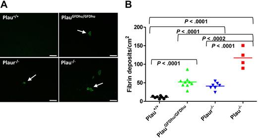 Figure 7. Fibrin accumulation caused by loss of uPA-uPAR interaction. (A) Representative low-magnification images of liver sections from Plau+/+ (top left), PlauGFDhu/GFDhu (top right), Plaur−/− (bottom left), and Plau−/− (bottom right) mice stained with fibrin-specific antibodies showing fibrin deposits. Size bars, 100 μm. (B) Enumeration of fibrin foci in the livers of Plau+/+ (left), PlauGFDhu/GFDhu (second left), Plaur−/− (second right), and Plau−/− (right) mice. Symbols represent individual mice. Horizontal bars show average values. P values were determined by the Student t test, 2-tailed.