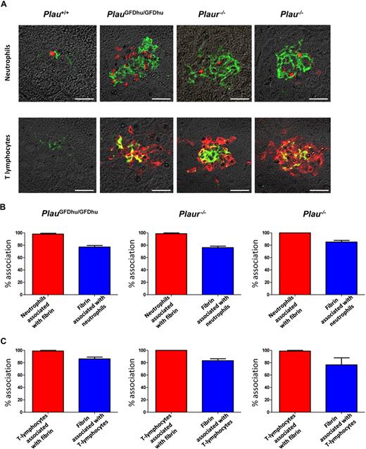 Figure 8. Inflammation caused by uPA-uPAR abrogation is secondary to fibrin deposition. (A) Examples of immunofluorescence using fibrin antibodies (green) combined with antibodies against neutrophils (myeloperoxidase, top panels) and T lymphocytes (CD3, bottom panels; red) of the livers from 1-year-old Plau+/+ (left panels), PlauGFDhu/GFDhu (2 left panels), Plaur−/− (2 right panels), and Plau−/− (right panels). Size bars, 20 μm. (B) Enumeration of the percentage of neutrophils associated with fibrin (red bars) and the percentage of fibrin deposits associated with neutrophils (blue bars) in the livers from PlauGFDhu/GFDhu (left), Plaur−/− (middle), and Plau−/− (right) panels. (C) Enumeration of the percentage of T lymphocytes associated with fibrin (red bars) and the percentage of fibrin deposits associated with T lymphocytes (blue bars) in the livers from PlauGFDhu/GFDhu (left), Plaur−/− (middle), and Plau−/− (right) panels.