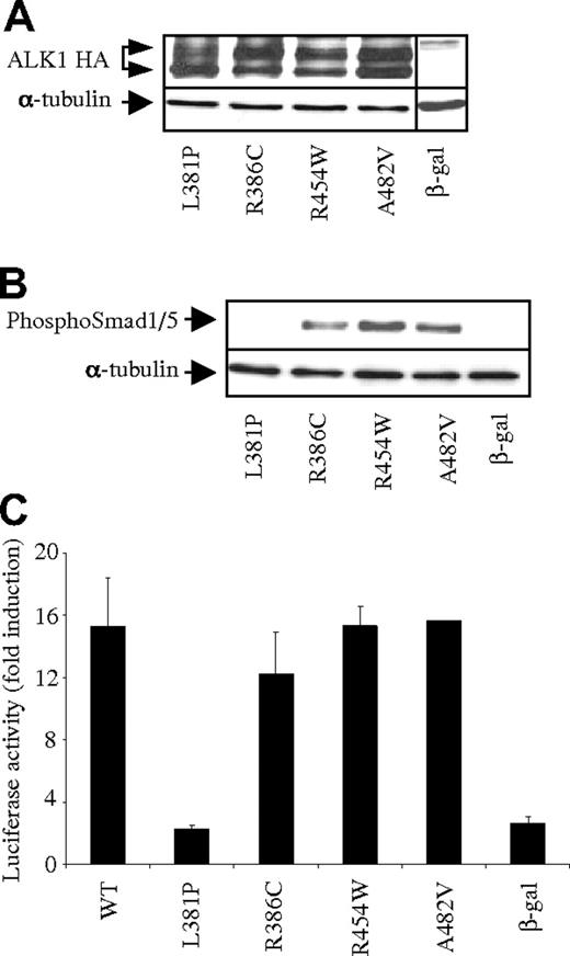 Figure 4. Functional analysis of the BMP9 response of conflicting ALK1 mutants. (A) Protein expression of WT-ALK1 or ALK1 mutants. Expression vectors encoding HA-tagged WT-ALK1 or ALK1 mutants or β-gal (control) were transiently transfected in NIH-3T3 cells for 24 hours. Cell lysates (20 μg proteins) were resolved by 10% SDS-PAGE and immunoblotted with antibodies against HA and α-tubulin (as a loading control). (B) Expression vectors encoding WT-ALK1 or the different ALK1 mutants or β-gal (control) were transiently transfected into NIH-3T3 cells. After 24 hours, cells were serum deprived for 1 hour and subsequently treated with BMP9 (100 pg/mL) for 1 hour. Cell lysates (20 μg proteins) were resolved by 10% SDS-PAGE and immunoblotted with antibodies against phosphoSmad1/5 or against α-tubulin (as a loading control). (C) NIH-3T3 cells were transiently transfected with pGL3(BRE)2-luc, pRL-TK-luc, and plasmids (0.5 ng) encoding either WT-ALK1 or the different ALK1 mutants or β-gal (control). After 4 hours, cells were treated (▬) with BMP9 (100 pg/mL) for 15 hours. The luciferase activities were then measured as described in “DNA transfection and dual luciferase activity assay.” The relative firefly luciferase activity was normalized to renilla luciferase activity. Results are expressed as fold induction over the value obtained for each ALK1 mutant in the absence of BMP9. Data are mean ± SD of 3 independent experiments.