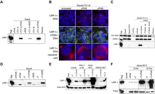 Figure 5. Induction of LMP-1 by activated CD4+ T cells in cocultures with EBV-positive BL cells. (A) Immunoblot analysis of LMP-1 expression in total cell extracts of the Daudi cells after 24 hours of coculture with nonactivated, PHA (5 μg/mL) activated, or SEB (5 μg/mL) activated peripheral blood (PB) CD4+ T cells (mixed in a 1:1 or 1:4 ratio). (B) Double immunofluorescence staining for LMP-1 and CD20 of the Daudi cells after 24 hours of coculture with nonactivated or PHA (5 μg/mL) activated PB CD4+ T cells (mixed in a 1:4 ratio). Nuclei were visualized with Hoechst 33258. The red staining of the white squared cells are shown at a higher magnification in the lower row. Images were generated with a Leitz DM RB microscope (Leica Microsystems) using a 63×/1.32 NA oil immersion objective lens. Images were captured with a Hamamatsu dual-mode cooled charged coupled device camera (C4880) and Hipic 6.4.0 software (Hamamatsu Photonics Deutschland). Pictures were edited for opitmal color contrast with Adobe Photoshop 7 (Adobe Systems). (C) Expression of LMP-1 and EBNA-1 in total cell lysates prepared from the Daudi cells cocultured for 24 hours with PHA (5 μg/mL) activated PB CD4+ T cells (ratio 1:1). In parallel cultures the Daudi cells were separated from the CD4+ T cells through a semipermeable membrane and cultured either in the lower or upper chamber of the Transwell plate. (D) Expression of LMP-1 in total cell lysates prepared from the Daudi cells cocultured for 24 hours with nonactivated, PHA (5 μg/mL) activated, or SEB (5 μg/mL) activated tonsillar total T cells (ratio 1:1). (E) Expression of LMP-1 and β-actin in total cell lysates prepared from the Daudi, Mutu I cl.59, Jijoye M13, or KMH2-EBV cells cocultured for 12 hours with nonactivated or PHA (5 μg/mL) activated CD4+ tonsillar T cells (ratio 1:1). As control the KMH2-EBV cells were also treated with 25 ng/mL IL-4 for 12 hours. (F) Immunoblot analysis of LMP-1 and Pax5 expression in total cell lysates prepared from the Jijoye M13 cells cocultured for 6 or 12 hours with nonactivated or PHA (5 μg/mL) activated CD4+ tonsillar T cells (ratio 1:1).