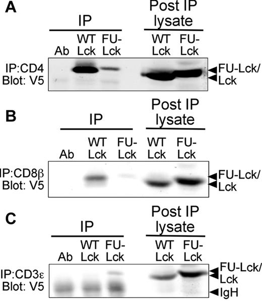 Figure 6. Altered intracellular localization of the FU-Lck protein. Coimmunoprecipitation experiments were undertaken to determine the association of transgenic Lck proteins with CD4, CD8, and CD3ϵ. CD4 (A), CD8β (B), or CD3ϵ (C) were immunoprecipitated from thymocyte lysates using mAbs and protein-A Sepharose. Association of Lcktg or FU-Lcktg proteins was assessed by Western blot analysis using the V5 mAb. Data shown represent 1 of 3 repeated experiments.