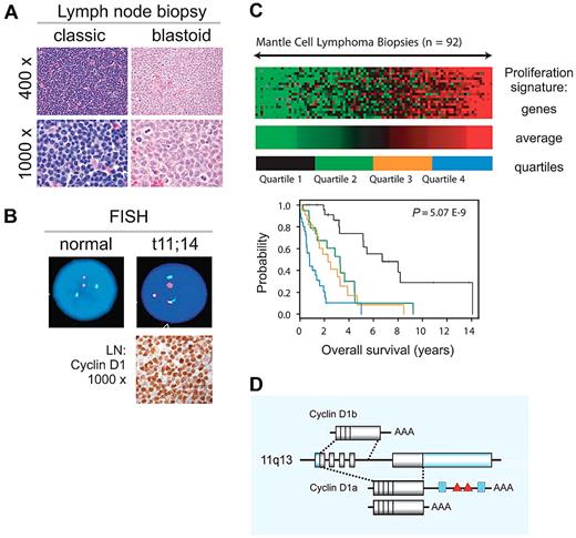 Figure 1. Clinical and biologic characteristics of MCL. (A) MCL diagnosis is based on morphology and immunophenotyping (CD20+, CD5+, CD23−, FMC7+). Pathologic subclassification recognizes 2 main subsets: classic and blastoid. (B) Fluorescence in situ hybridization (FISH) cytogenetics showing translocation t(11;14)(q13;q32) and immunohistochemistry for detection of cyclin D1 overexpression are helpful adjuncts in the diagnosis of MCL. Immunohistochemistry images provided by Stefania Pittaluga; images of FISH testing provided by Diane C. Arthur. (C) Tumor proliferation determines outcome. Figure adapted from original5 with permission. The expression levels of 20 genes related to cell proliferation were summarized in the proliferating signature average. Lowest (green) to highest (red) expression of the proliferation signature average in lymph node biopsies from 92 patients with MCL is shown with across a 16-fold range. Kaplan-Meier analysis for patients grouped into 4 quartiles on the basis of this score is shown. (D) CCND1 locus at 11q13 and cyclin D1 mRNA isoforms. Shaded boxes represent coding sequences, open boxes represent noncoding exon sequences. The 3′UTR of full-length 4.5-kb cyclin D1a contains binding sites for miRs (blue boxes) and AU-rich elements (red triangles); cyclin D1a isoforms with a truncated 3′UTR lack these elements. The alternatively spliced 1.7-kb cyclin D1b mRNA lacks exon 5 and retains part of intron 4. Illustration by Paulette Dennis.