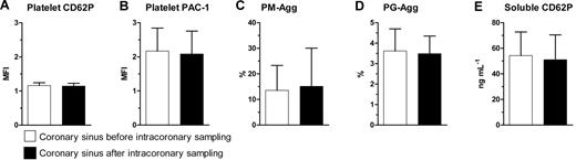 Figure 2. Comparison between coronary sinus samples taken before and after sampling in the coronary arteries. (A) Platelet CD62P, (B) platelet PAC-1, (C) platelet-monocyte aggregates (PM-Agg), (D) platelet-granulocyte aggregates (PG-Agg), and (E) soluble CD62P. MFI indicates mean fluorescence intensity. P = not significant for all comparisons shown. Solid bars and error bars represent mean ±SD.