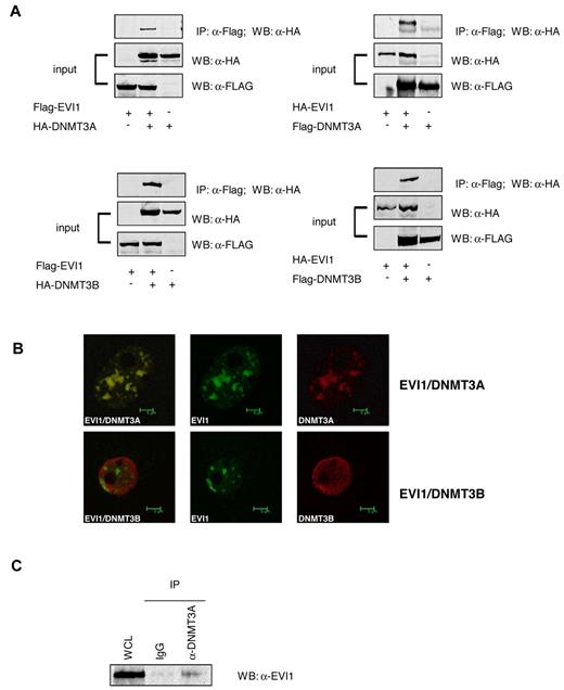 Figure 3. EVI1 interacts with DNMT3A and DNMT3B. (A) Western blot analysis using anti-FLAG antibodies shows the input of the immunoprecipitation of transfected 293T cells and the pulldown using anti-HA. (B) Confocal microscopy of 293T cells transfected with HA-tagged EVI1 (green) and FLAG-tagged DNMT3A and DNMT3B (red). (C) Western blot for EVI1 on lysates from SB1960CB cell line. The left lane shows the input band; the second and third lanes show EVI1 staining after immunoprecipitation with IgG control and anti-DNMT3A, respectively.