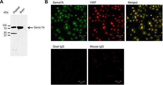 Figure 4. Sema7A is present in human platelets. (A) Western blot of human platelet and brain lysates. (B) Confocal microscopy of activated human platelets allowed spreading on a fibrinogen-coated surface showing sema7A on the surface and colocalizing with VWF in α-granules.
