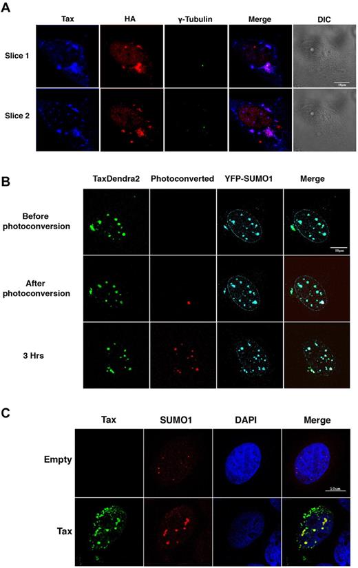 Figure 2. Tax trafficking between SUMO-enriched nuclear bodies. (A) HeLa cells were cotransfected with Tax and HA-ubiquitin and stained by immunofluoresence with anti–HTLV-I sera (blue), anti-HA polyclonal antibody (red) and anti–γ-tubulin mAb (green). Original colors of the immunofluoresence have been changed for clarity reasons. The 2 lanes represent different sections of the same cell. (B) HeLa cells were cotransfected with Tax-Dendra2 (2 μg) and SUMO1-YFP (50 ng). Irreversible photoconversion from green to red was performed on selected nuclear bodies 4 hours after transfection using a 405 laser. Cells were imaged using a LSM510 META laser confocal microscope in the green (lane 1) and red channels (lane 2) before and after photoconversion. Scale bar, 10 μm. (C) HeLa cells were transfected with Tax or empty vector and stained by double immunofluoresence with anti-Tax mAb (green) and anti-SUMO1 polyclonal antibody (red).