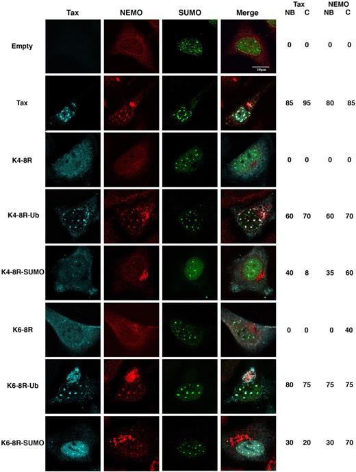 Figure 4. Tax ubiquityaltion and SUMOylation control NEMO targeting into distinct subcellular compartments. HeLa cells were cotransfected with HA-SUMO1 and Tax, empty vector (control), or the Tax mutants K4-8R, K4-8R-Ub, K4-8R-SUMO1, K6-8R, K6-8R-Ub, or K6-8R-SUMO1, and stained by triple immunofluorescence with anti-Tax (blue), anti-HA (green), and anti-NEMO (IKK-γ) antibodies (red). Cells were examined by confocal microscopy. Scale bar, 10 μm. The percentage of cells displaying Tax or NEMO localization into nuclear bodies (NBs) and/or centrosome (C) are indicated.