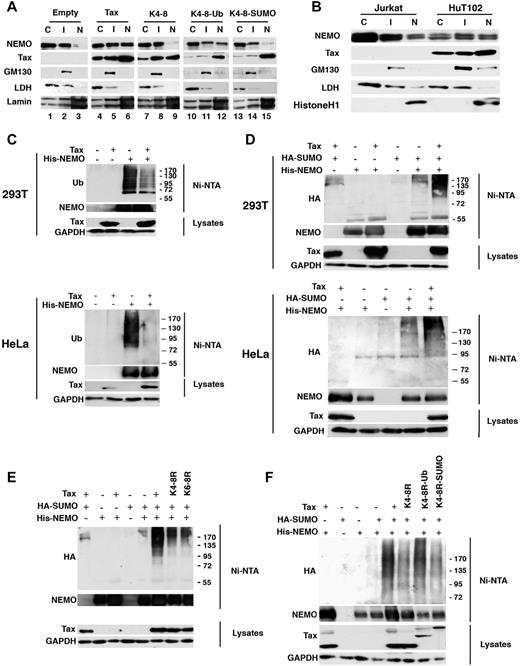 Figure 5. Tax induces nuclear accumulation and SUMOylation of NEMO. (A) HeLa cells were transfected with empty vector, Tax, or Tax mutants K4-8R, K4-8R-Ub, or K4-8R-SUMO1 plasmids. Cell fractionation was performed as described in the Methods. Lysates from the nuclear fraction (N), the soluble cytosolic fraction (C), and the intermediate fraction (I), were blotted with different antibodies as indicated. (B) Cell fractionation was performed on HTLV-I–negative Jurkat cells and on HTLV-I–infected HuT-102 cells as described in panel A. (C) 293T and HeLa cells were cotransfected with His-NEMO and Tax plasmids and proteins purified by denaturing Ni-NTA pull-down were blotted with mAb against polyubiquitylated proteins (FK2) and a polyclonal antibody against NEMO (top panel). Lysates were blotted with mAb against Tax or GAPDH (bottom panel). (D-F) 293T or HeLa cells were cotransfected with His-NEMO, HA-SUMO1, and Tax plasmids or the Tax mutants K4-8R, K6-8R, K4-8R-Ub, K4-8R-SUMO1 plasmids, and proteins purified by denaturing Ni-NTA pull-down were blotted with mAb against HA and a polyclonal antibody against NEMO. Lysates were blotted with mAb against Tax or GAPDH.