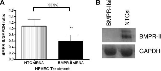 Figure 1. BMPR-II expression in HPAECs treated with siRNA-targeting BMPR-II or a nontargeting control siRNA. RNA was harvested from mock-transfected HPAECs or those transfected with BMPR-IIsi or NTC siRNA. Expression of BMPR-II was determined using qPCR (TaqMan; A) using primers specific for BMPR-II or Western blotting (B). For TaqMan, data are the mean ± SEM for 5 independent experiments. **P < .001, compared with HPAECs transfected with NTCsi by Student t test.