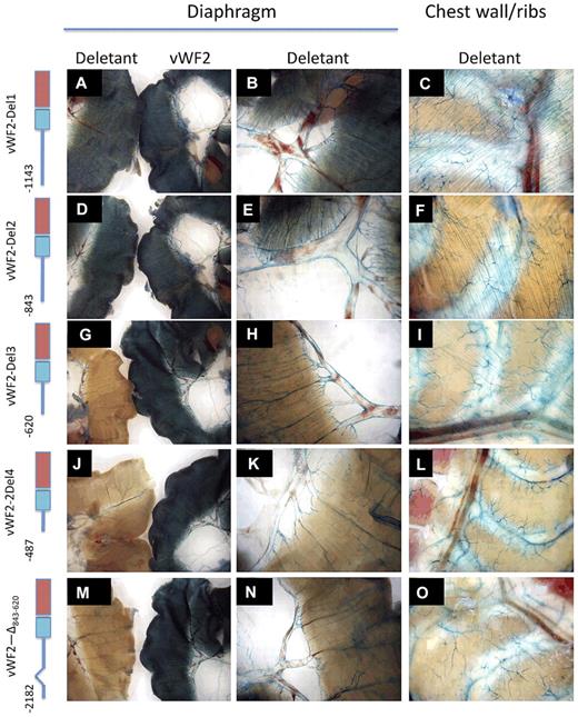 Figure 2. LacZ staining of diaphragm and chest wall from Hprt-targeted mice carrying vWF2-lacZ or deletant VWF promoter-lacZ constructs. Diaphragms and chest walls were harvested from 6- to 8-week-old F2 male Hprt-targeted mice carrying vWF2-lacZ or deletant VWF transgenes and processed in parallel for whole-mount staining with X-Gal. In the left-most column (A,D,G,J,M), the diaphragm from the vWF2-lacZ transgenic mouse is on the right, and the diaphragm from the deletant VWF transgenic mouse is on the left. Panels in the second column (B,E,H,K,N) represent higher power images of the deletant VWF transgenic tissues shown A, D, G, J, and M, respectively. Wild-type vWF2-lacZ and all 5 deletant VWF transgenic mice demonstrate LacZ staining in macrovessels of skeletal muscle (diaphragm and intercostal muscle). However, note the loss of microvascular LacZ staining in vWF2-Del3-lacZ, vWF2-Del4-lacZ, and vWF2-Δ843-620-lacZ tissues. Whole-mount tissues were analyzed under a Nikon SMZ-U dissecting microscope, and microphotographs were collected using a Nikon Coolpix 8400 camera.