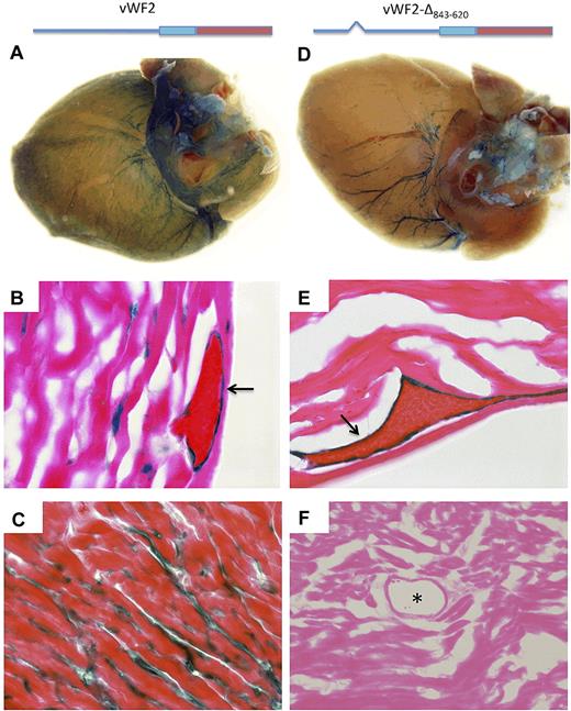 Figure 3. LacZ staining of heart whole mounts and tissue sections from vWF2-lacZ and vWF2-Δ843-620-lacZ mice. Hearts were harvested from 6- to 8-week-old F2 male Hprt-targeted mice carrying vWF2-lacZ transgene (A-C) or vWF2-Δ843-620-lacZ transgene (identical to vWF2 except for an internal deletion of DNA sequences between −843 and −620; D-F) and processed in parallel for whole-mount (A,D) or cryosection (B-C,E-F) staining with X-Gal. vWF2-lacZ and vWF2-Δ843-620-lacZ transgenic hearts demonstrate LacZ staining in veins. However, note loss of capillary endothelial staining in the vWF2-Δ843-620-lacZ heart. Whole-mount hearts were analyzed under a Nikon SMZ-U dissecting microscope, and microphotographs were collected using a Nikon Coolpix 8400 camera. Tissue section images were obtained using a ×100 objective (B,E), ×60 objective (C), or ×40 objective (F). Lac-Z-stained sections were counterstained with eosin. Slides were analyzed under a Zeiss Axio Imager upright microscope, and photomicrographs were collected using a Zeiss Axiocam MRc camera and Axiovision 4.6.3 image acquisition software. Arrow, LacZ staining in venous endothelial cells. Asterisk, lumen of an artery.