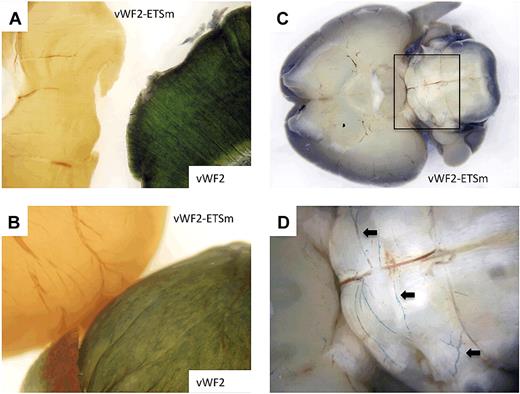 Figure 6. LacZ staining of diaphragm, heart, and brain from Hprt-targeted mice carrying vWF2-lacZ or vWF2-ETSm-lacZ. Diaphragms, hearts, and brains were harvested from 6- to 8-week-old F2 male Hprt-targeted mice carrying vWF2-lacZ or vWF2-ETSm-lacZ and processed in parallel for whole-mount staining with X-Gal. (A) The diaphragm from the vWF2-lacZ transgenic mouse is on the right, and the diaphragm from the vWF2-ETSm-lacZ mouse is on the left. (B) The vWF2-lacZ heart is on the bottom, and the vWF2-ETSm-lacZ heart is on the top. (C-D) The vWF2-ETSm-lacZ brain at low and high power, respectively (panel D is from the inset shown in panel C). Note the lack of detectable LacZ staining in skeletal muscle (diaphragm) and heart. Whole-mount tissues were analyzed under a Nikon SMZ-U dissecting microscope, and microphotographs were collected using a Nikon Coolpix 8400 camera. Arrows, LacZ-positive blood vessels in posterior brain.
