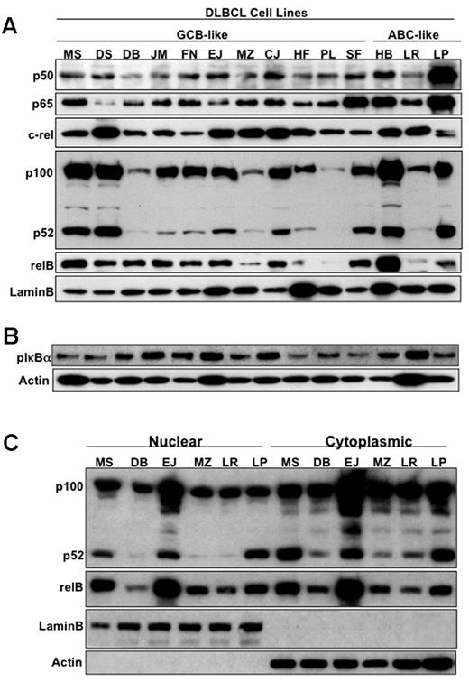 Figure 1. Identification and characterization of NF-κB family members in DLBCL subsets. (A) Nuclear extracts purified from DLBCL cell lines (GCB-like and ABC-like, as indicated) were subjected to Western blot analysis with p50, p52, p65, c-rel, relB, and lamin B antibodies. (B) Cytoplasmic extracts purified from DLBCL cell lines (GCB-like and ABC-like, as indicated) were analyzed by Western blot analysis with phospho-IκBα and actin antibodies. (C) 6 DLBCL cell lines (4 GCB-like and 2 ABC-like) were used to purified cytoplasmic and nuclear extracts and were subjected to Western blot analysis with p52, relB, lamin B (nuclear marker), and actin (cytoplasmic marker) antibodies.