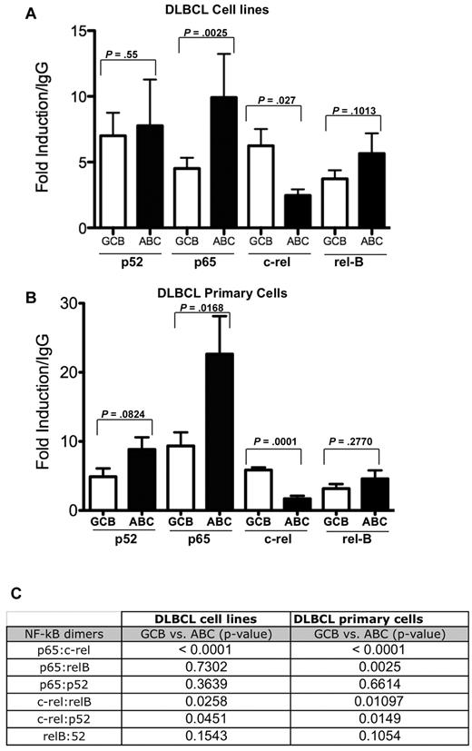 Figure 3. NF-kB DNA-binding analysis in DLBCL cell lines and primary samples. Statistical comparison of each NF-kB component DNA-binding activity in GCB versus ABC DLBCL cell lines (A) and DLBCL primary cells (B) were assessed by the Student t test of average value from the ELISA data in supplemental Figure 2A and B. P < .05 was considered statistically significant. (C) Six possible NF-kB dimer ratios obtained from the ELISA data in supplemental Figure 2A and B for DLBCL cell lines and primary samples, respectively, were compared in GCB versus ABC DLBCL subtypes by the Student t test. P < .05 was considered statistically significant.
