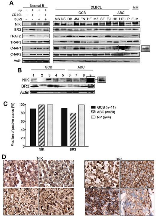 Figure 4. NIK kinase protein accumulates in DLBCL tumor cells. (A) Cell lysates of normal/activated B cells and DLBCL cell lines were probed with NIK, TRAF2, TRAF3, BR3, c-IAP1, or c-IAP2 antibodies in Western blot analyses. Actin was used as a loading control. Box to the right indicates lighter exposure. (B) Cell lysates of DLBCL lymphoma patient biopsies were probed with NIK and BR3 antibodies in Western blot analysis. Actin was used as a loading control. Box to the right indicates lighter exposure. (C) DLBCL TMA analyzed for NIK and BR3 protein expression. Immunohistochemical analysis of DLBCL patient sample TMA of 43 primary DLBCL biopsies using antibodies against NIK and BR3 proteins. Tissue arrays with duplicate samples were scored using an automated analysis system for percentage of positive cells (> 30%) staining for NIK and BR3 protein in the DLBCL subgroups GCB, ABC, and non-profiled (NP; supplemental Figure 1). (D) Representative DLBCL TMA stained for NIK and BR3. Images are representative of the biopsy cores from the DLBCL TMA slides.