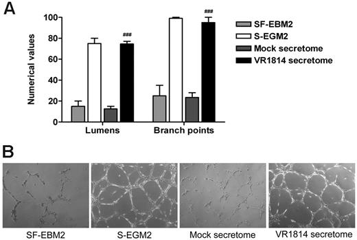 Figure 1. Supernatants from HCMV-infected ECs induce AG. (A) Quantitative measures of AG consisted of the number of lumens and branch points. The results are expressed as mean ± SD, ##P < .01 versus mock. (B) Representative examples of each culture condition are shown as a low-power image (magnification, ×10).