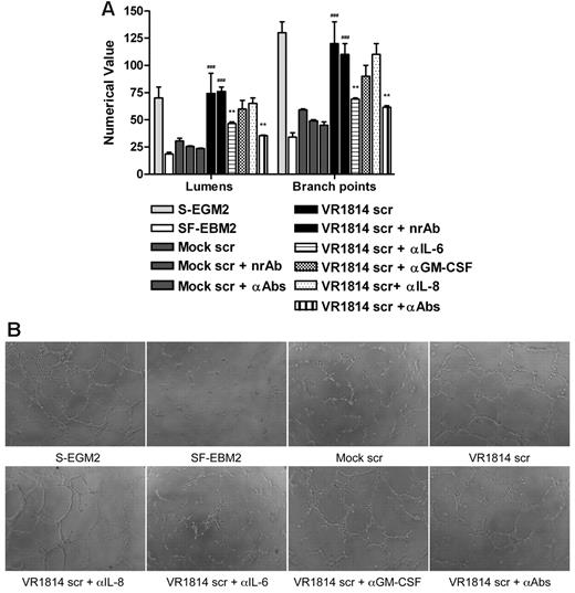Figure 3. Neutralization of IL-6 decreases AG and vessel stabilization at 1 week. (A) Quantification of Matrigel tube formation assay after 24 hours in the presence of mock secretome (Mock scr), mock secretome with a nonrelated antibody (Mock scr + nrAb), mock secretome with anti–IL-6, anti–GM-CSF, and anti–IL-8/CXCL8 (Mock scr + αAbs), HCMV VR1814 secretome (VR1814 scr), HCMV VR1814 secretome with a nonrelated antibody (VR1814 scr + nrAb), HCMV VR1814 secretome with anti–IL-6 antibody (VR1814 scr + αIL-6), HCMV VR1814 secretome with anti–GM-CSF antibody (VR1814 scr + αGM-CSF), HCMV VR1814 secretome with anti–IL-8/CXCL8 antibody (VR1814 scr + αIL-8), and HCMV VR1814 secretome with anti–IL-6, anti–GM-CSF, and anti–IL-8/CXCL8 antibodies (VR1814 scr + αAbs). The results are expressed as mean ± SD, ###P < .001 versus mock, **P < .01 versus HCMV VR1814 secretome. (B) Representative examples of each culture conditions are shown as a low-power image (magnification, ×10). (C) Tubule survival is shown after 1 week on Matrigel in the presence of mock secretome, HCMV VR1814 secretome, HCMV VR1814 secretome with anti–IL-6 antibody (VR1814 scr + αIL-6) at low-power image (magnification, ×10), and at high-power image (magnification, ×20).