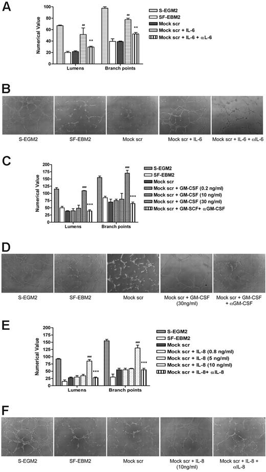 Figure 4. Exogenous IL-6, GM-CSF, and IL-8 promote HUVEC tube formation. (A) Quantification of Matrigel tube formation assay after 24 hours in the presence of human recombinant IL-6 (10 ng/mL). The results are expressed as mean ± SD, ##P < .01 versus mock, **P < .01 versus mock + IL-6. (B) Representative examples of each culture condition are shown as a low-power image (magnification, ×10). (C) Quantification of Matrigel tube formation assay after 24 hours in the presence of increasing concentrations of GM-CSF. The results are expressed as mean ± SD, ###P < .001 versus mock, ***P < .001 versus mock + GM-CSF (30 ng/mL). (D) Representative examples of each culture condition are shown as a low-power image (magnification, ×10). (E) Quantification of Matrigel tube formation assay after 24 hours in the presence of increasing concentrations of IL-8/CXCL8. The results are expressed as mean ± SD, ##P < .01 versus mock, **P < .01 versus mock + IL-8/CXCL8. (F) Representative examples of each culture condition are shown as a low-power image (magnification, ×10).